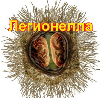 Легионелла - возбудитель болезни легионеров