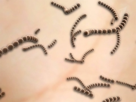 Амоксил Инструкция При Ангине